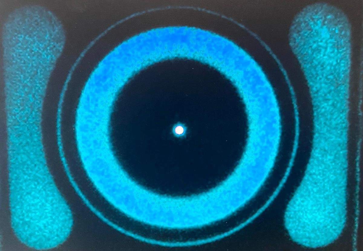 Clinical SPECT gamma-camera acquisition